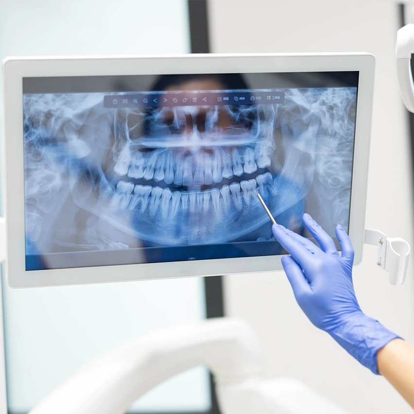 口腔内写真やモニターを使った見える説明