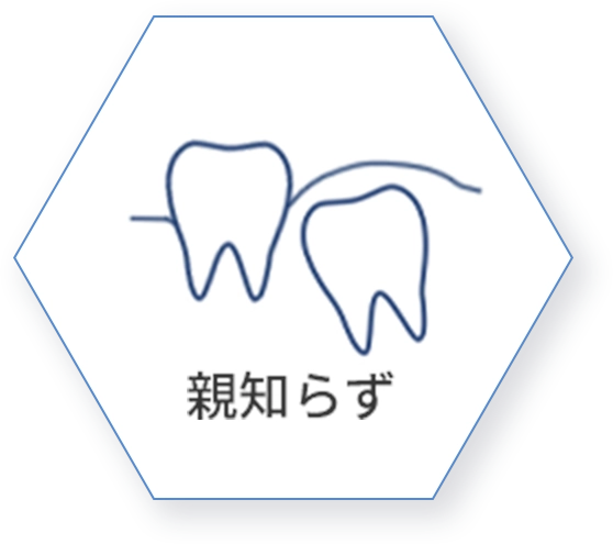 親知らず治療