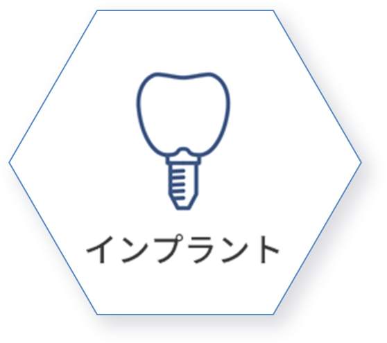 インプラント