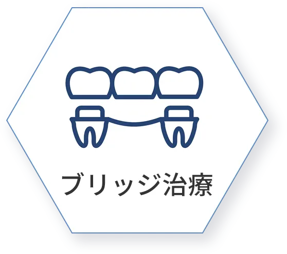 ブリッジ治療