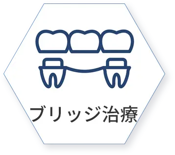 ブリッジ治療