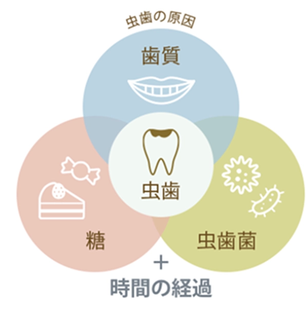 予防のポイント