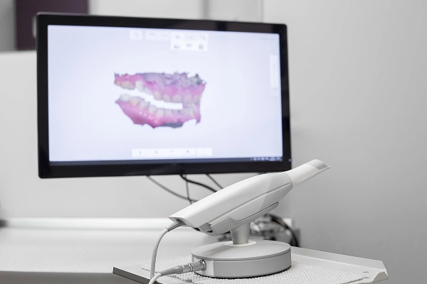3Dスキャナーによる精密な歯並びの分析