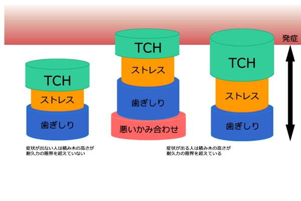 無意識に歯を当てる癖を減らす